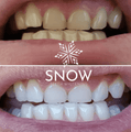 SNOW® AT-HOME TEETH WHITENING ALL-IN-ONE KIT