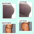 Butt-Lift Shaping Patch