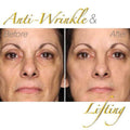Youth Power 24K Gold Peel-Off Mask