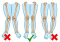 Premium Orthopedic Insoles