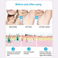 100% Organic Permanent Hair Growth Inhibitor Set