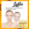 Pigment Zero Niacinamide Ampoule